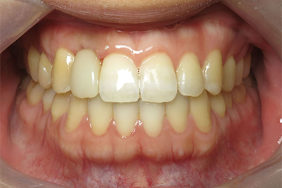 Ortho & Implant After